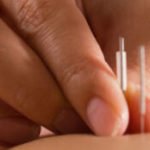 Acupuncture in Curing Both Male and Female Infertility