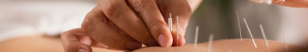 Read more about the article Acupuncture in Curing Both Male and Female Infertility